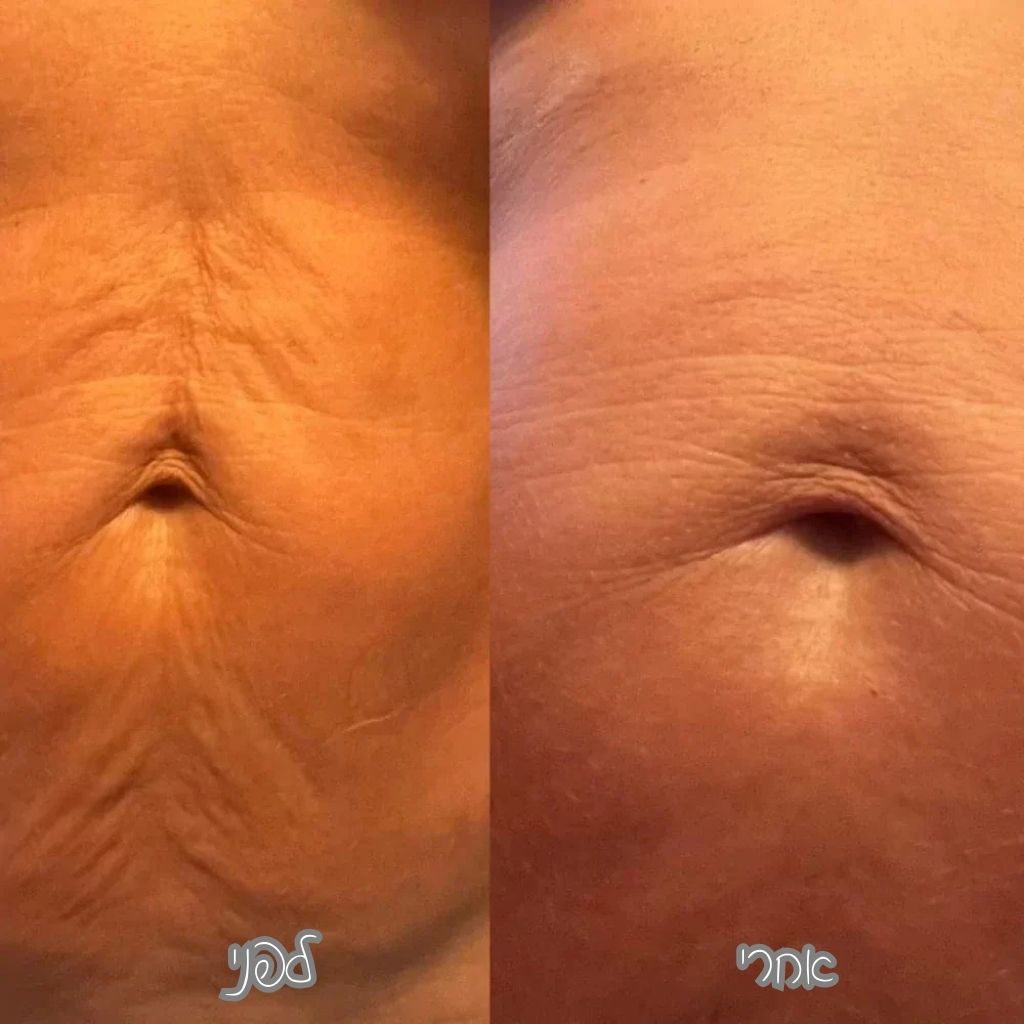 ๐งด ืฉืื ืืืืฆืืง ืืืืืช ืืืืฃ