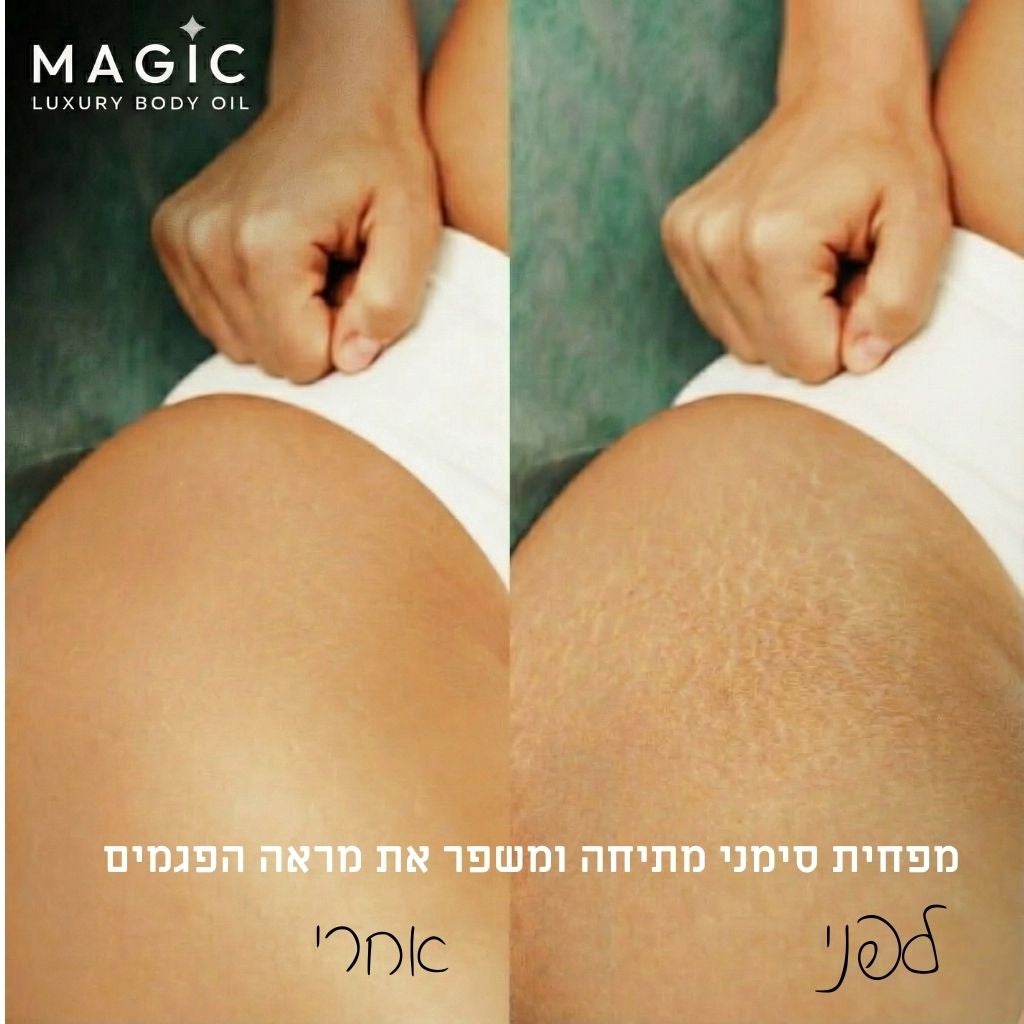 ๐งด ืฉืื ืืืืฆืืง ืืืืืช ืืืืฃ